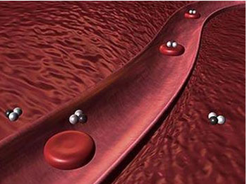 高血脂与生化检查血脂的注意事项