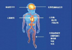 国康全自动生化分析仪提是您高血脂危害人体健康