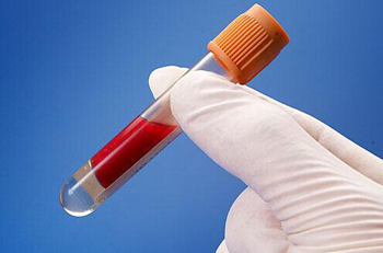 全自动生化分析仪的检测样本是血清还是全血2