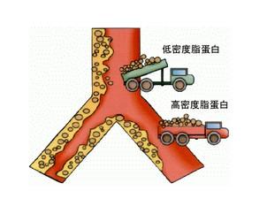 全自动生化分析仪可以检测胆固醇么