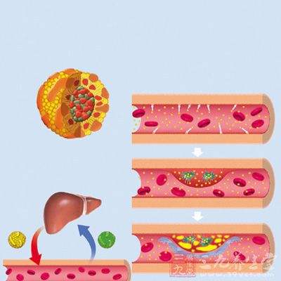 山东国康生化分析仪检测血清总胆固醇的临床意义