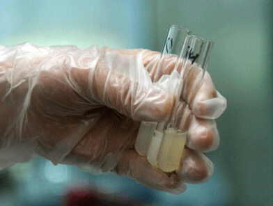 生化仪品牌男性不孕不育来个精液生化全套检查